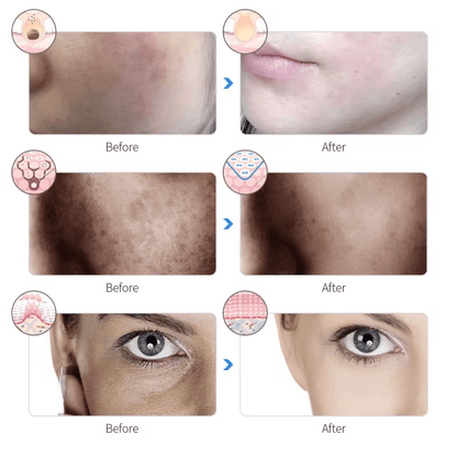 Gleamsi Glow Mask for Radiant Skin and Youthful Complexion - Gleamsi