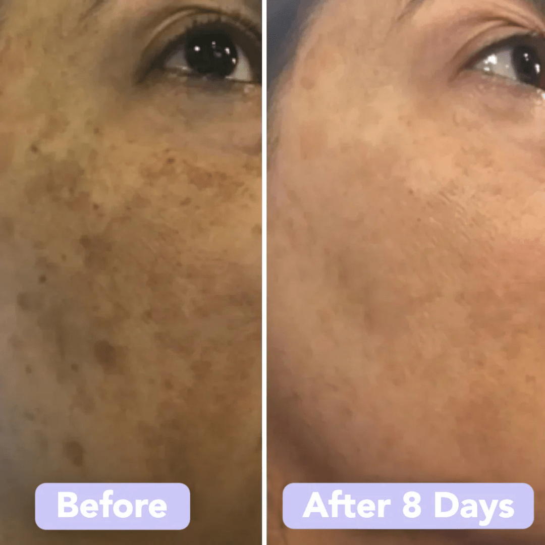 Gleamsi Glow Pads for Radiant Skin and Instant Glow - Gleamsi
