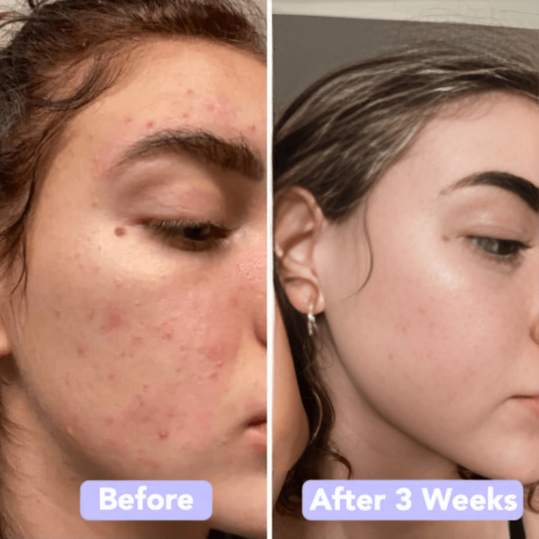 Gleamsi Glow Pads for Radiant Skin and Instant Glow - Gleamsi
