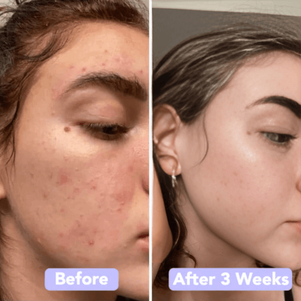 Gleamsi Glow Pads for Radiant Skin and Instant Glow - Gleamsi