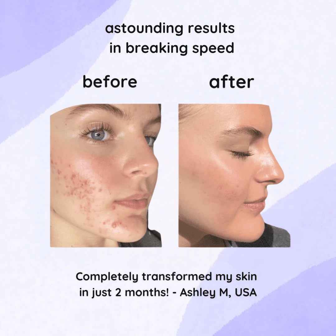 Gleamsi Glow Pads for Radiant Skin and Instant Glow - Gleamsi