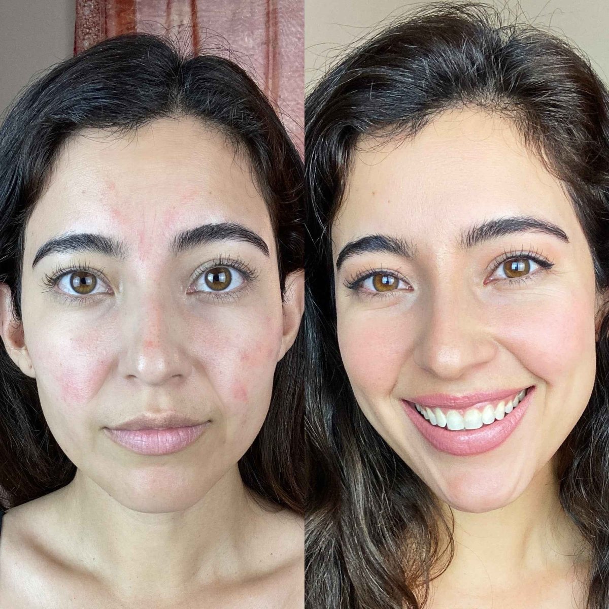 Gleamsi Skin Revive Wand Revitalize Your Skin - Gleamsi