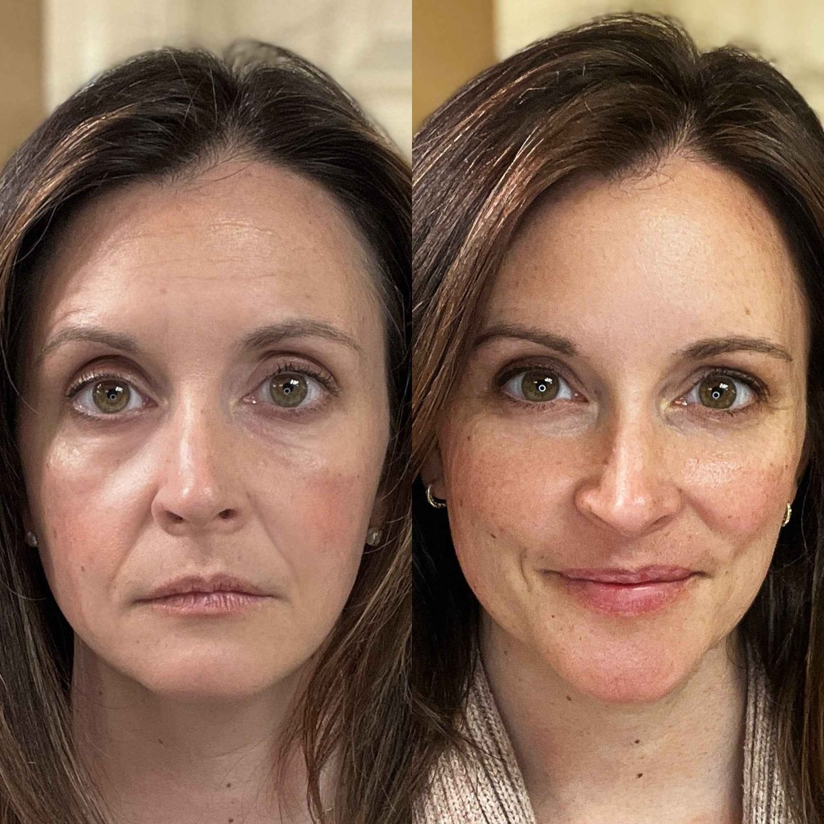 Gleamsi Skin Revive Wand Revitalize Your Skin - Gleamsi