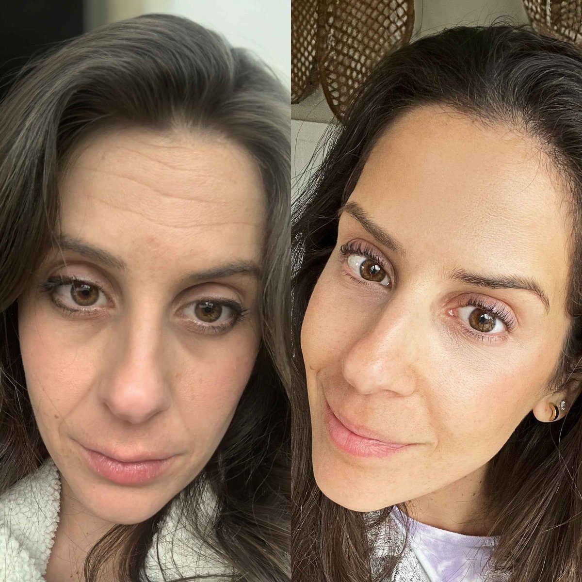 Gleamsi Skin Revive Wand Revitalize Your Skin - Gleamsi