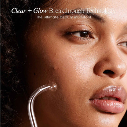 YouthGlow High - Frequency Wand - Gleamsi
